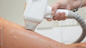 Worker of spa salon evenly makes laser hair removal on woman client leg with wax in office. Use of electrical equipment in medical facility