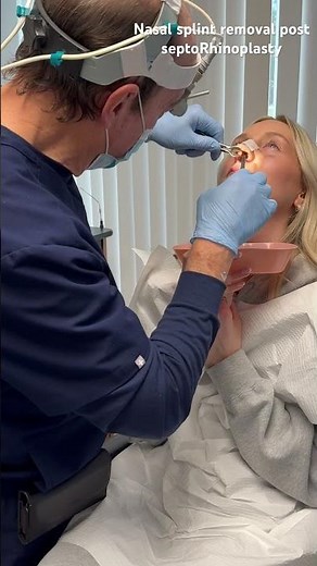 Removal of nasal splint 6 days post op septohinoplasty #rhinoplasty