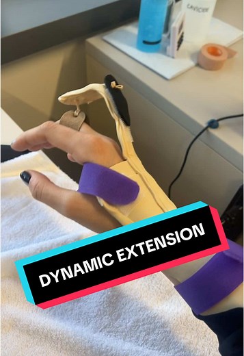 DYNAMIC SPLINTING. #realpost I used to be TERRFIED as a newer hand therapist of getting a referral to make one because all of the little tools were unfamiliar to me & I never properly learned how to use them/fasten them. I knew I needed to play around with all of it before I sat for the CHT exam so I would be prepared if I ever needed to make one for a patient. I made this dynamic extension splint on my down time completely out of scrap thermoplastic, so don’t mind the aesthetic 😅. I am having