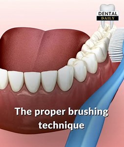 33K views · 544 reactions | How to brush your teeth properly | Dental Daily | Facebook