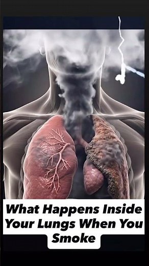 What Happens Inside Your Lungs When You Smoke #anatomy #health #doctor