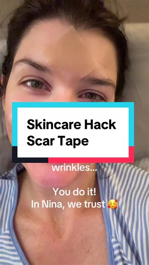 Scar Tape for Wrinkles: A Skincare Secret from Nina