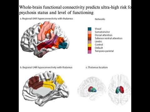 602-Whole-Brain Connectivity Predicts Psychosis Risk