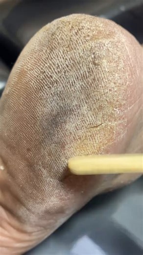 Who puts Candle wax on feet 😳