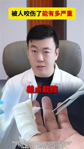 How Dangerous Can a Bite Be? Reveal the Health Truth