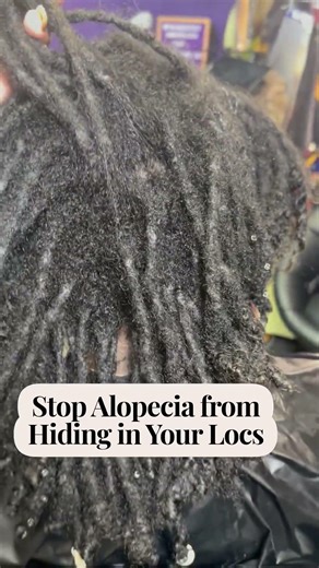 Understanding Alopecia in African American Hair