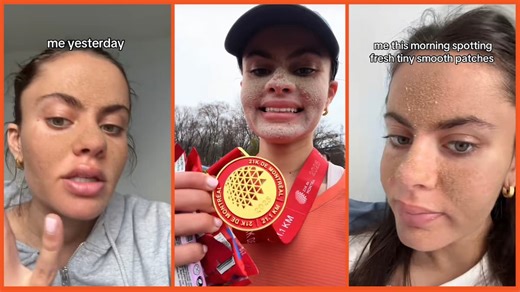 ‘There is a fungus eating away at her face’: TikToker refuses to use any skin care products on her face, even WATER, and the results are horrifying