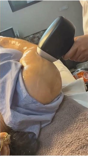 Struggling with loose or sagging skin? #skintightening #skincare #laser #shorts #delhi