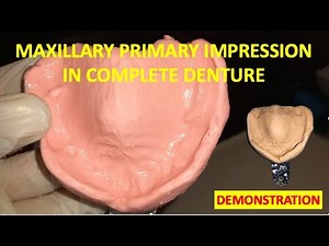 MAXILLARY PRIMARY IMPRESSION IN EDENTULOUS JAW // COMPLETE DENTURE// TRAY SELECTION ‪@dentalcafe4331‬