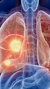 6.9K views · 106 reactions | Effects of Cigarettes #shorts #cigarettes #effects #marrigeproblems | Dr Tahira Rubab Clinical Psychologist | Facebook