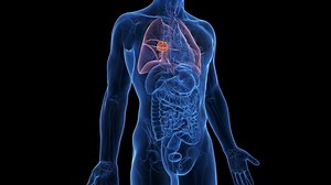 3d rendered medical animation of a lung tumor