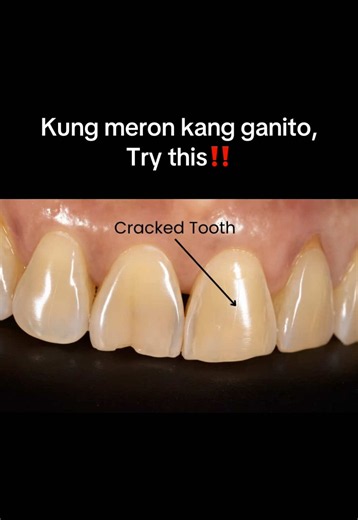 Toothpaste Whitening: How Whitening Toothpaste Repairs Enamel