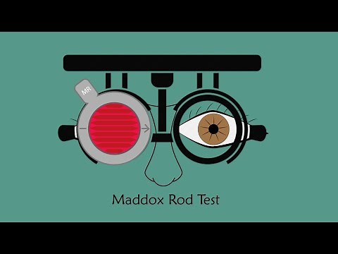 Maddox Rod Test