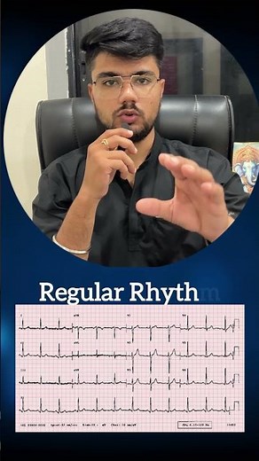 ECG Heart Rate Calculation Made Super Easy 🔥 (Regular Rhythm)