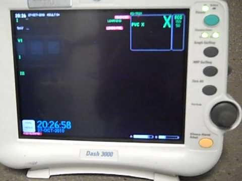 GE Dash 3000 monitor review