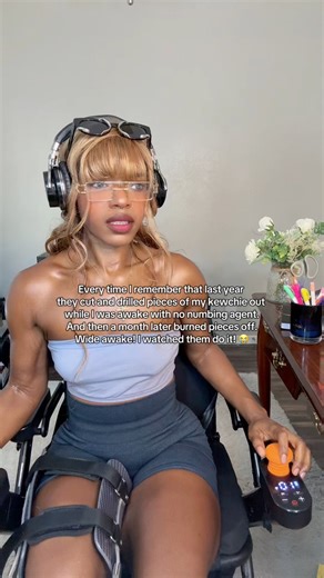 794K views · 5.2K reactions | I’ve been through some craaaazy sh*t man and I’m only in my 20s  That colposcopy was the worse pain I’ve ever felt in my LIFE. #leep #leepprocedure #colposcopy #femalehealth #womenshealth #papsmear | The Real Gailina | Facebook