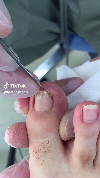 #pedicure #nails #relax #podologia #decompression #foryoupage TikTok