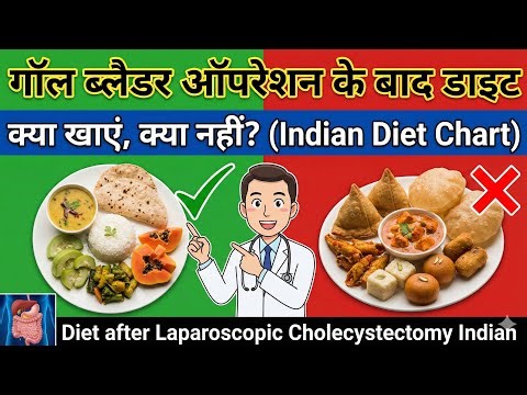 What to eat after Gallbladder operation, Diet after Laparoscopic Cholecystectomy Indian