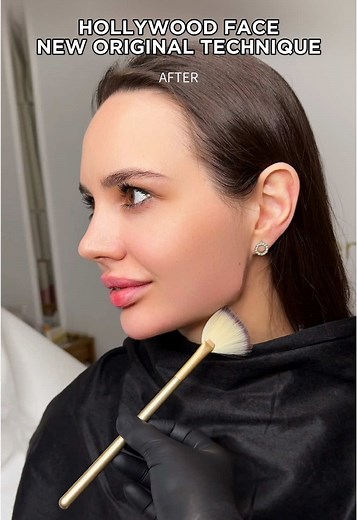 New original technology “Hollywood face” face harmonisation Before or After? 📍Moscow | Dubai | London appointments Schedule an appointment with one of our talented aesthetic doctors 👉 Sign up now: www.LFK-academy.com #recommendations #cosmetology #skincare #fyp #fashion #estetik #lipfiller #jawline #fullface #botox #lifting #beauty#увеличениегуб #увеличениегубмосква #fullface #fullfaceмосква #fullfaceuk #lipfillersessex #lipaugumentation #коррекцияскул #lipfilleruk #коррекцияугловмосква #корре