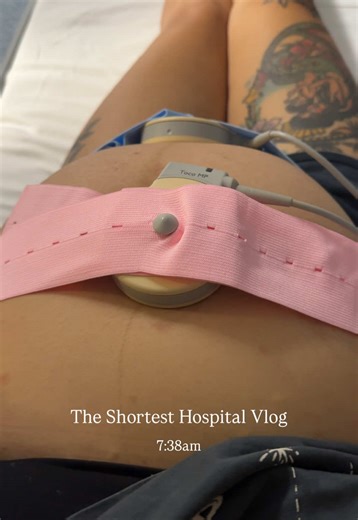 Spontaneous Labor and Emergency C-Section Experience