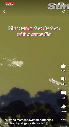 From the sun .. a man survives his crocodile encounter .. #crocodile #swimming #survivor #luckyescape
