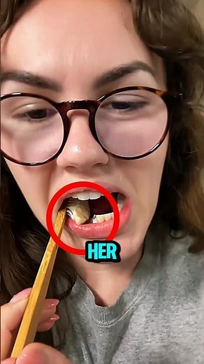 One Broken Tooth Turned Into a Bigger Problem 😱