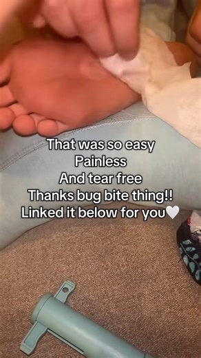 😱 You won't believe what came out of this one... #pimplepop #satisfying | Dr.Thomas Animal Care