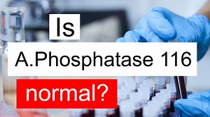 Is Alkaline phosphatase 116 normal, high or low? What does ALP level 116 mean?