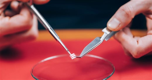 Droga LSD pode reduzir os sintomas de ansiedade? Estudo revela que sim