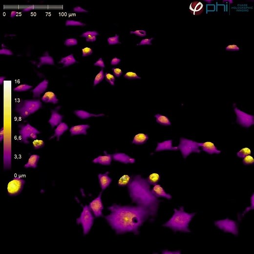 Live-cell microscopy of Fibroblast Cells | HoloMonitor®