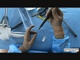 Laparoscopic Linear Cutter Staplers • Video • MEDtube.net