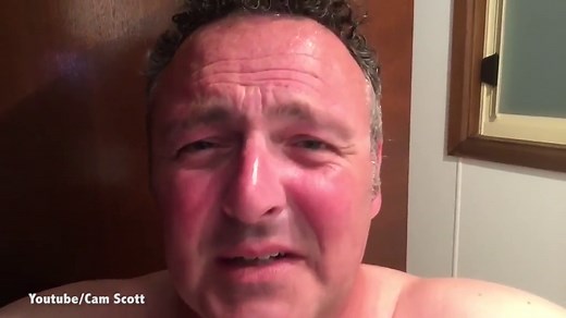 Guy can't stop laughing as he suffers reverse hiccups