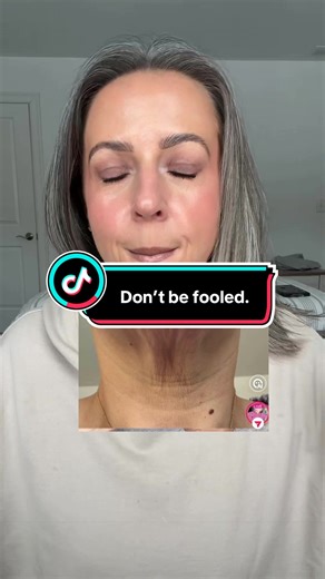 Truth About Skincare Marketing vs Botox