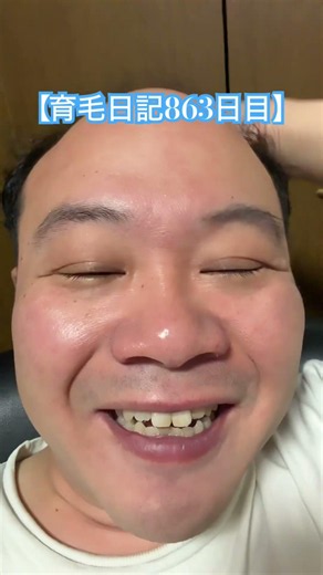 [Hair Growth Diary Day 863] Heading out for octopus fishing at the crack of dawn tomorrow 🐙 #Live...