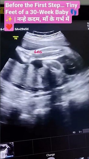 Before the world sees them, these tiny feet are already growing with love 👣💖30 weeks inside the womb