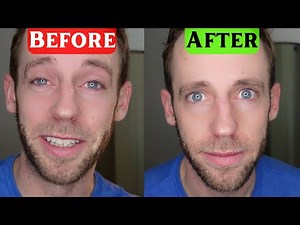 Clear Eyes Maximum Redness Relief Eye Drops REVIEW