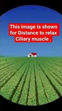 What you See Vs What Doctor Sees?🔥👁#shorts #eyetest #viral #how