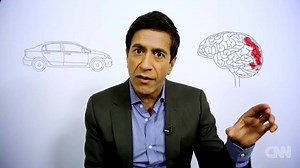 360K views · 1.5K shares | A lot of people think they are good at...