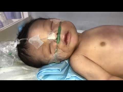 High-Risk Post-Term Newborn | Cyanosis case #newborn #baby