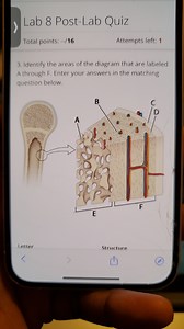 Identify the areas of the diagram that are labeled A through F.... | Filo
