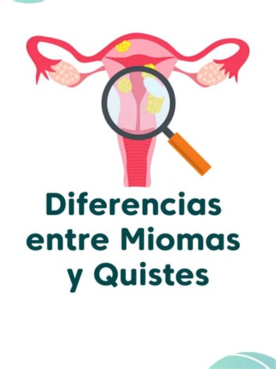 ✨👩‍⚕️ Miomas y quistes: términos comunes, pero condiciones diferentes. Aunque ambos pueden presentarse en la salud ginecológica, sus características y manejo son distintos. Conocer la diferencia es fundamental para un diagnóstico oportuno. Consulta a tu especialista y agenda tu estudio. 📲 9932315899 o visítanos en 📍 Av. Niños Héroes Esq. Calle Río Samaria No. 196. Col. Atasta, CP. 86100. Villahermosa, Tabasco. 👨‍⚕️ Dr. Luis Alberto Fontiselly Hernández / Médico Cirujano 🏫 Universidad Juárez