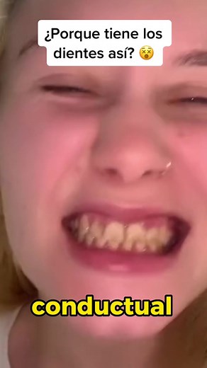 Amelogenesis Imperfecta: Causas y Tratamientos Dentales