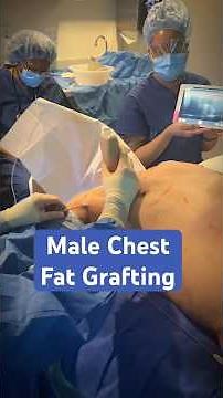 👉 Inside the OR: Male Chest Fat Grafting with Ultrasound - Dr. Nye | West End Plastic Surgery
