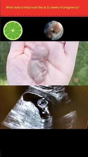 11 Weeks Pregnant? | Baby’s Rapid Growth and Development Milestones This Week