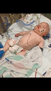 376K views · 16K reactions | Update Baby Juvan "When the doctors incubated Juván for the ventilator, he went into cardiac arrest. They performed CPR for 20 minutes, and by God’s grace, his heart started beating again. He is now stable but on a ventilator, not out of danger yet. By some miracle Dr Harilal got a cvp line for Juván in!!!! Please keep our brave little boy in your prayers". #PrayForJuván #MiracleBaby #FaithOverFear | Arms of Mercy NPC | Facebook