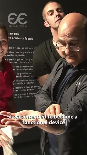 The man who gave his body an extra ear