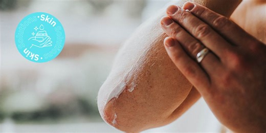 Skin Solutions: Your definitive guide to psoriasis