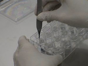 A Novel In Vitro Wound Healing Assay to Evaluate Cell Migration