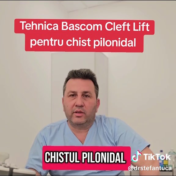 Tehnica Bascom Cleft Lift pentru boala pilonidala