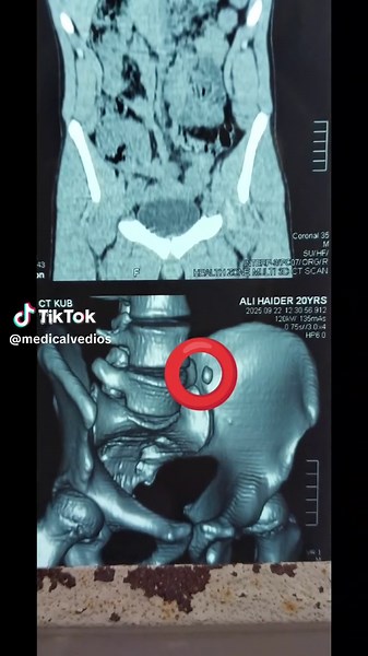 Understanding Instrument Engineering for Students